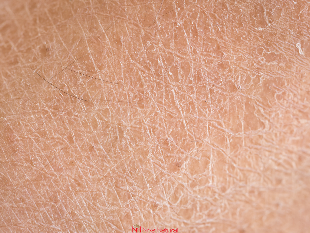 oxidative stress on the skin