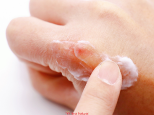 kako negovati ispucalu kozu na rukama