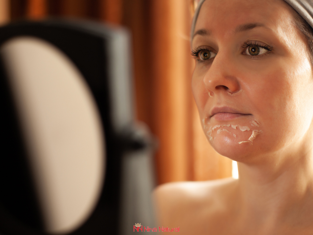 ljuštenje i perutanje posle pilinga
