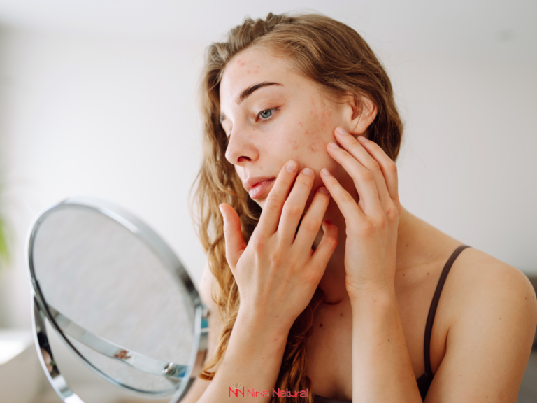 koža oštećena pilingom